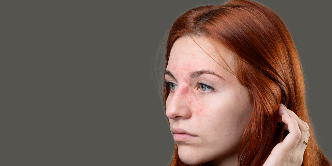 Sensitive Skin