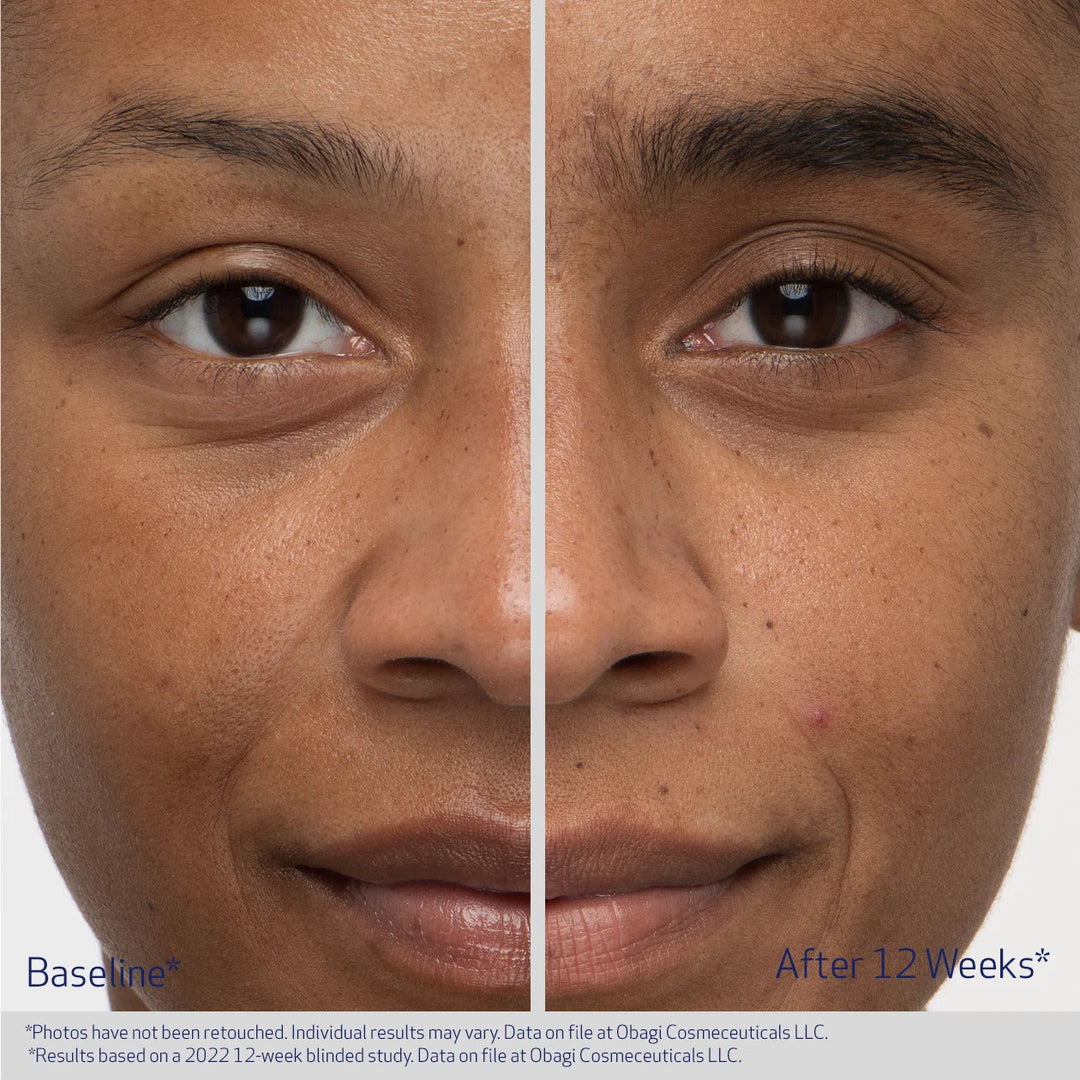 Before and after comparison of a person&