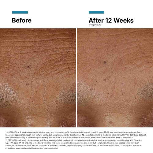 Botox® Bundle