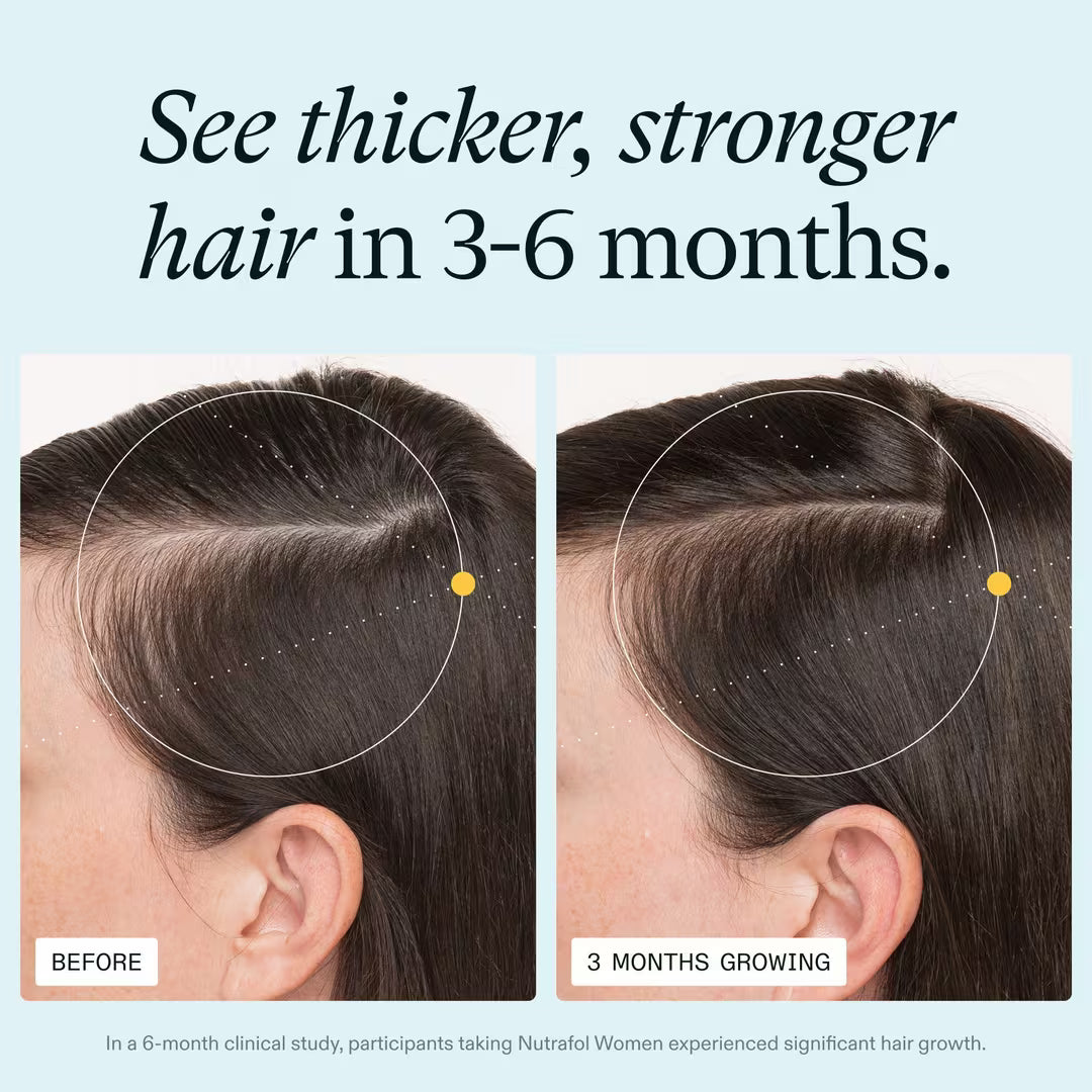 Before and after comparison of hair growth with text indicating results in 3-6 months.