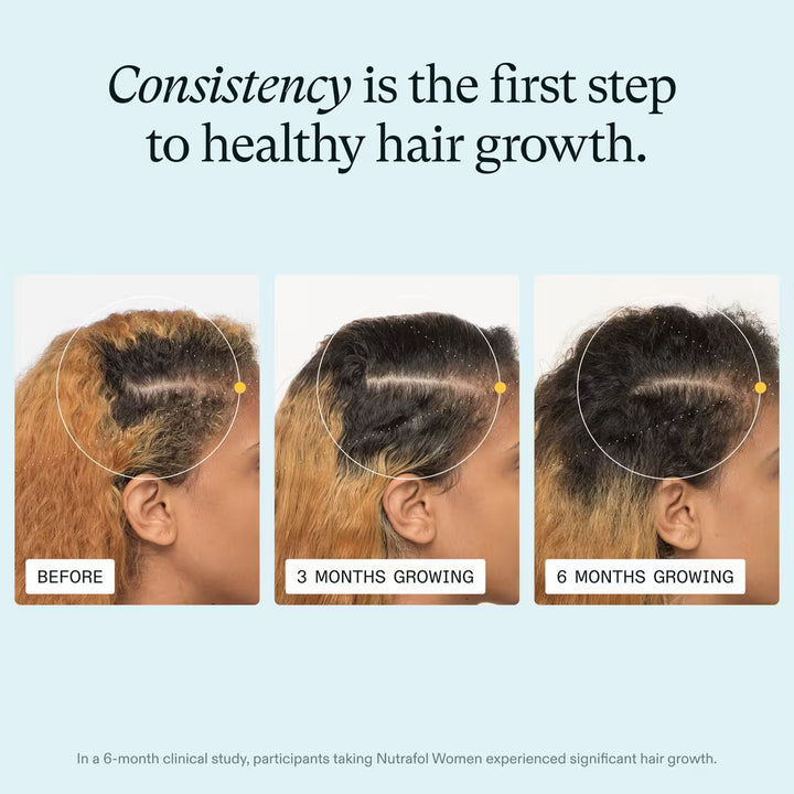 Before and after hair growth comparison with text &