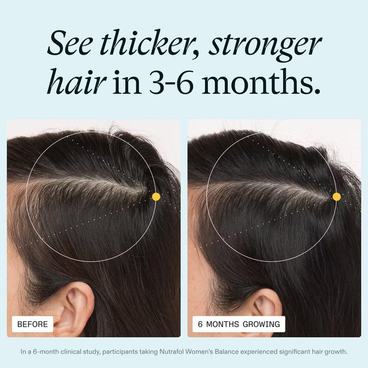 Before and after comparison of hair growth with text indicating results in 3-6 months.