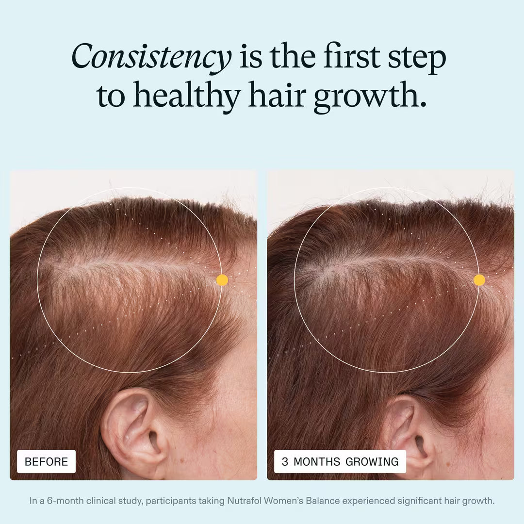 Before and after comparison of hair growth with text &