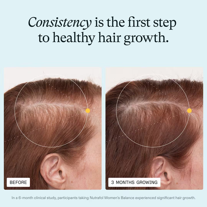 Before and after comparison of hair growth with text &