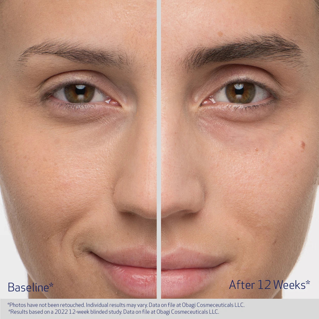 Before and after comparison of a person&
