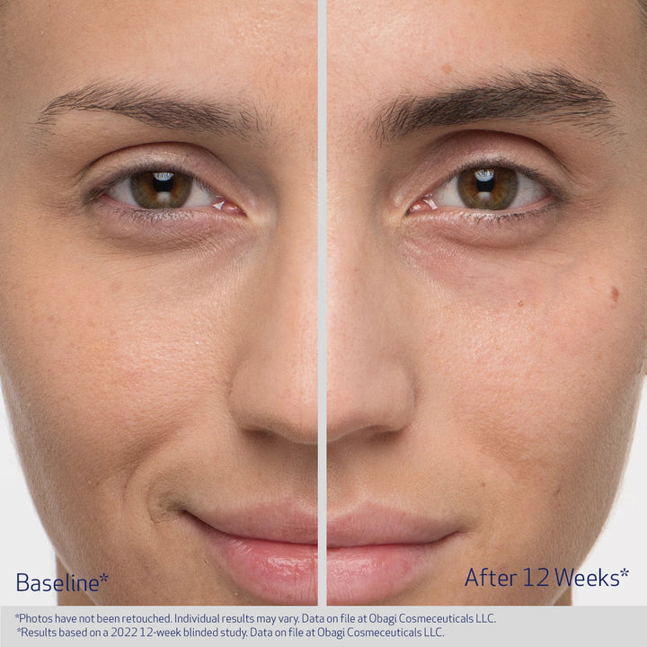 Before and after comparison of a person&