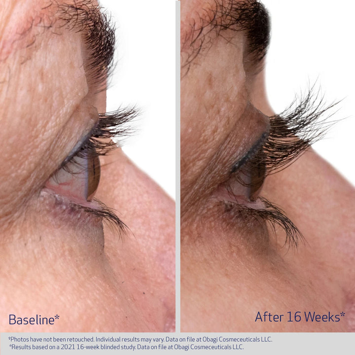 Before and after comparison of eye area treatment showing reduced redness and swelling.