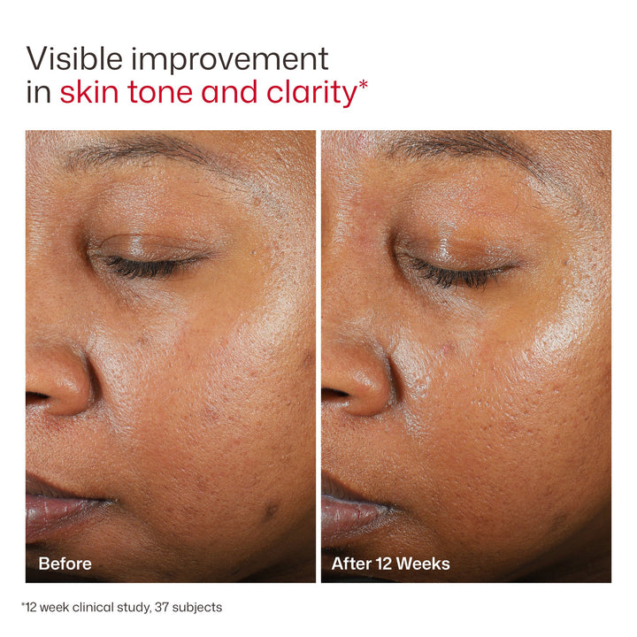 UV Clear Broad-Spectrum SPF 46