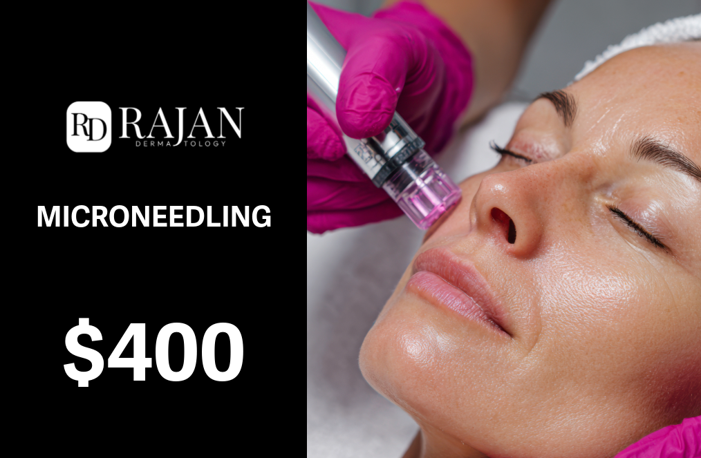 Microneedling Gift Card
