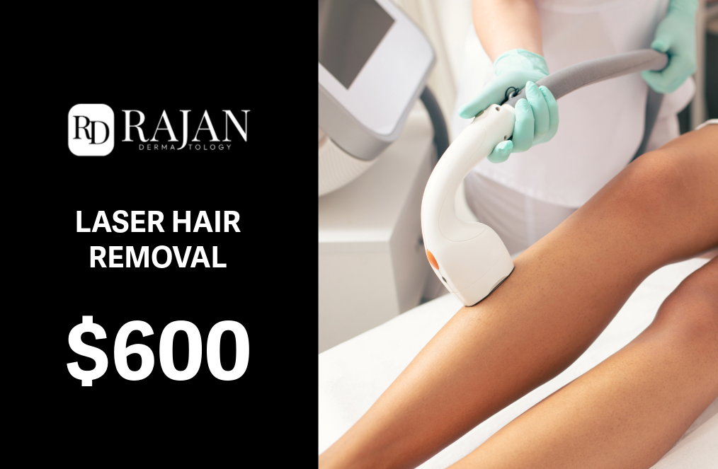 Laser Hair Removal Gift Card