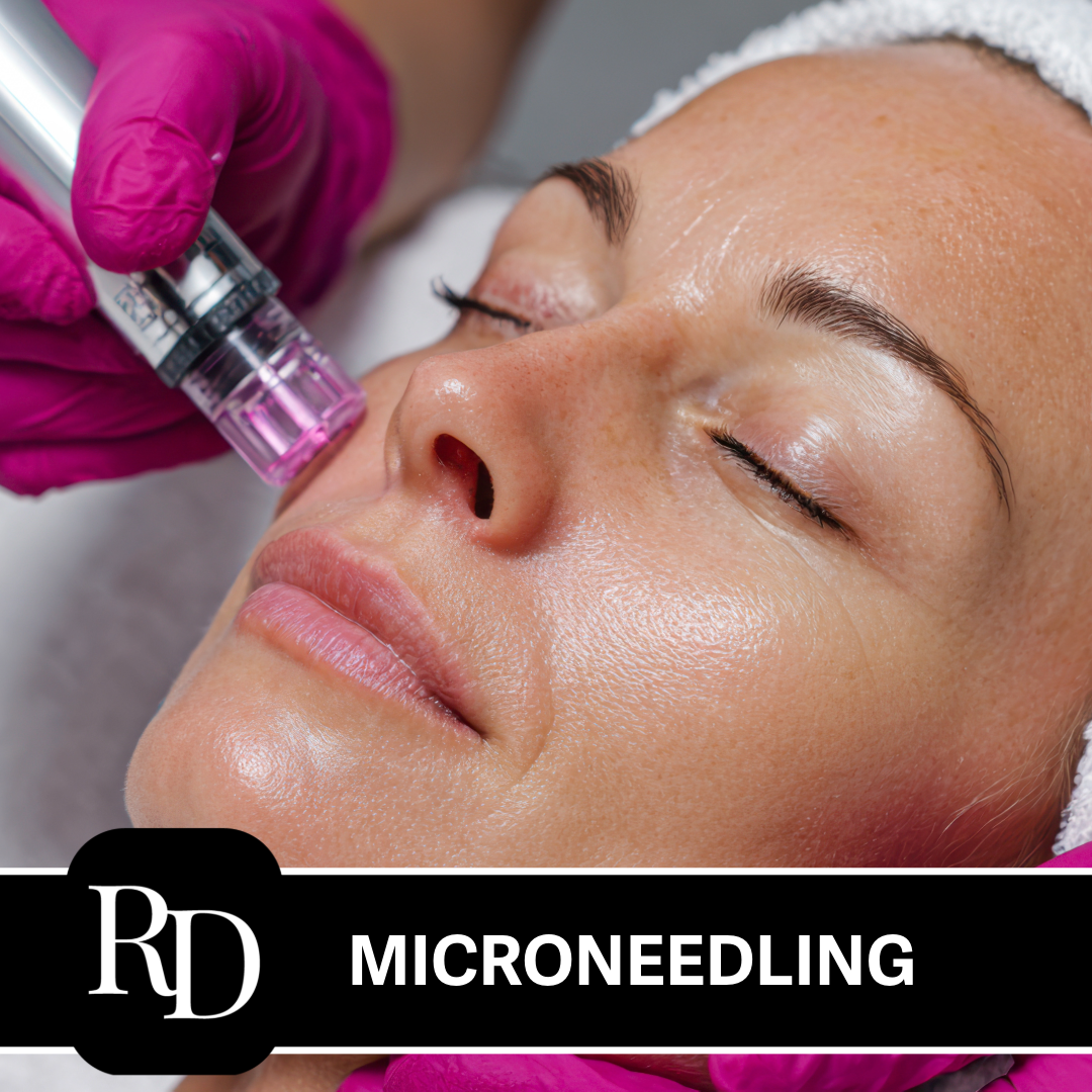 Microneedling Gift Card