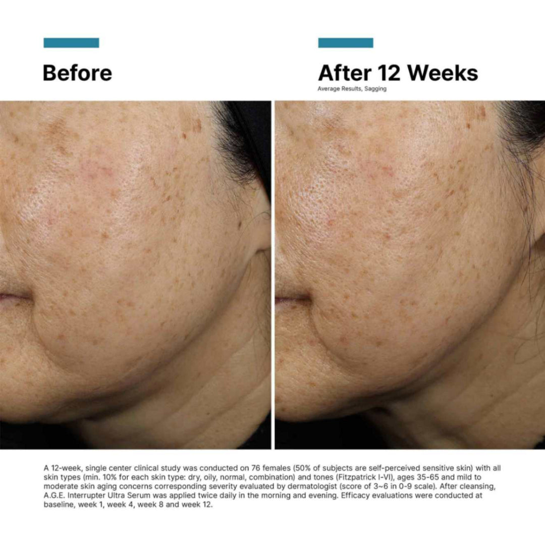 A.G.E. Interrupter Ultra Serum