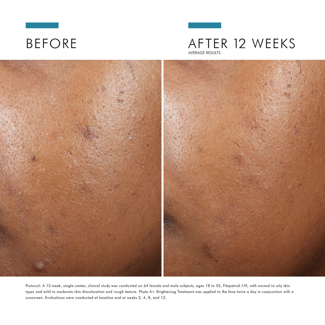 Phyto A+ Brightening Treatment